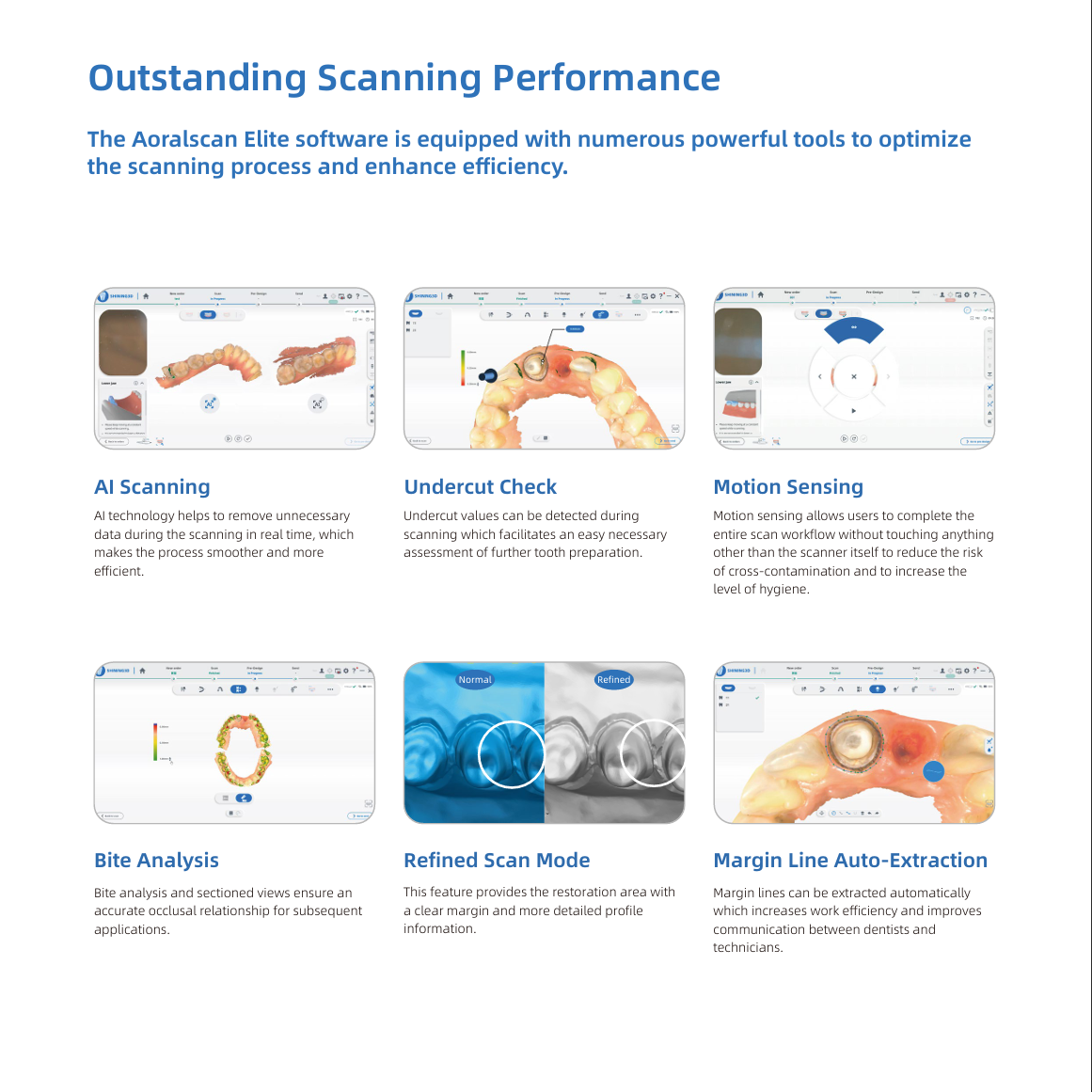 Aoralscan ELITE - Shining 3D