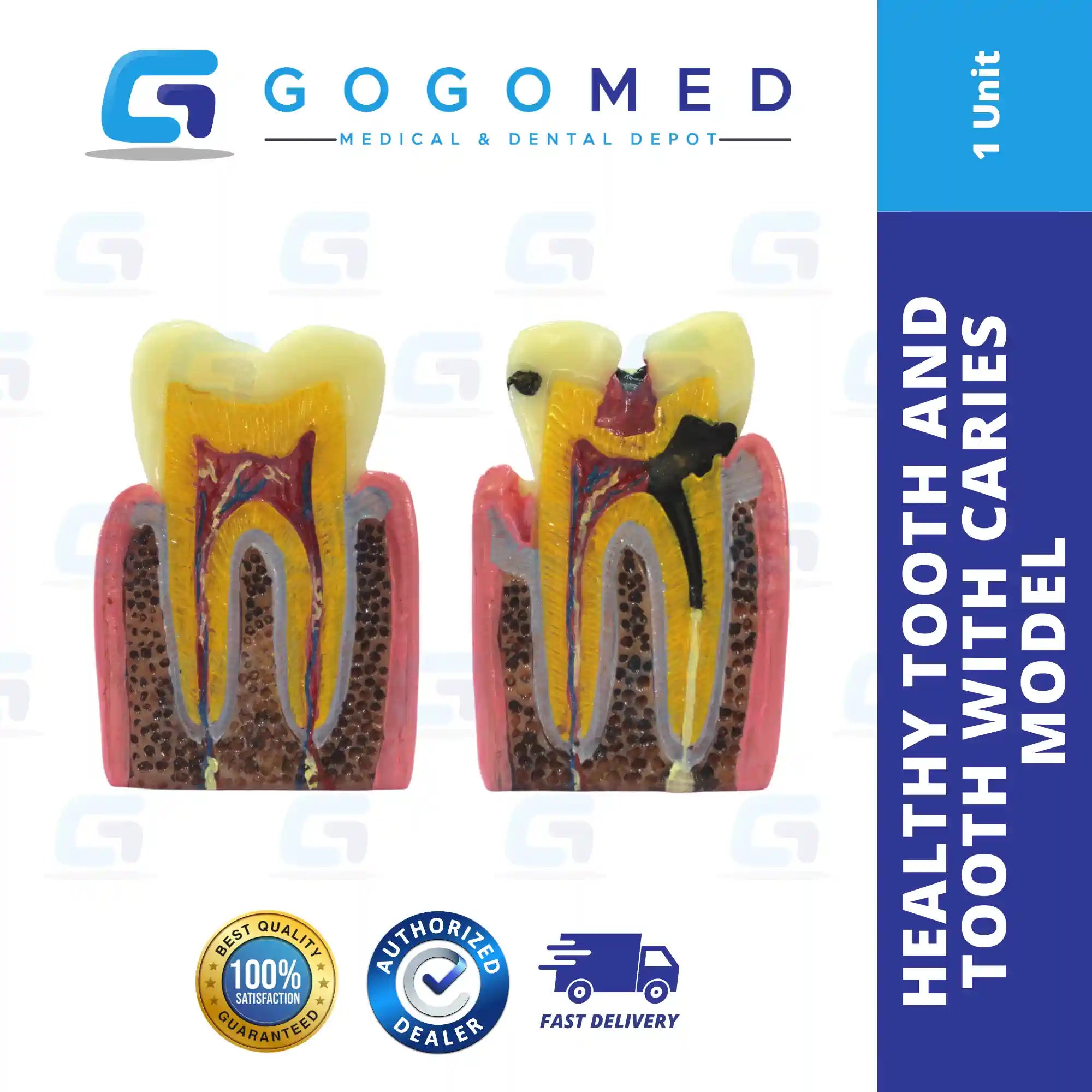Healthy Tooth and Tooth with Caries