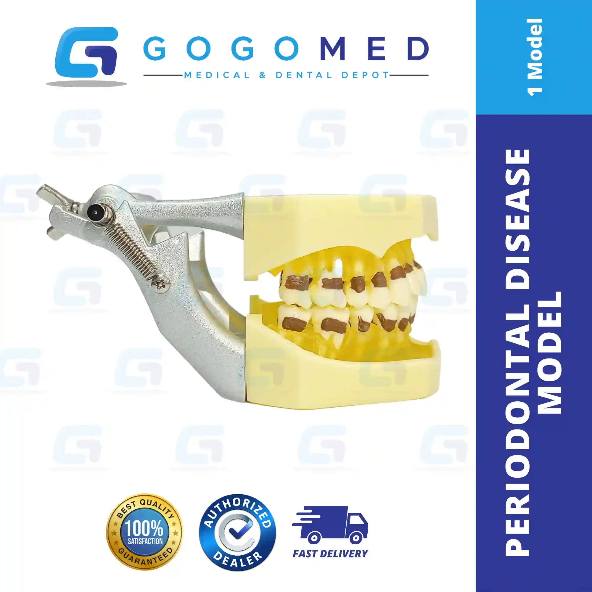 Periodontal Disease Model