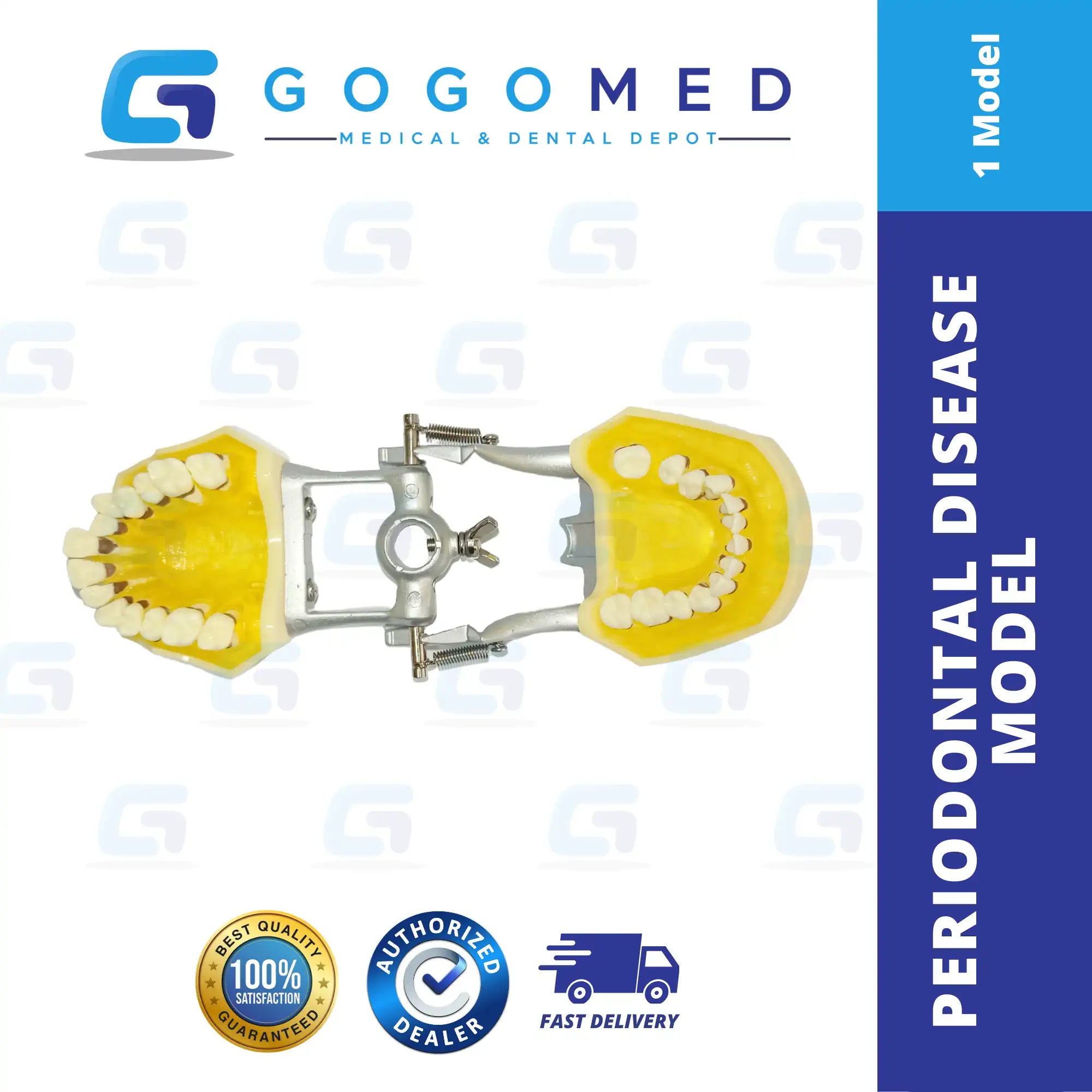 Periodontal Disease Model