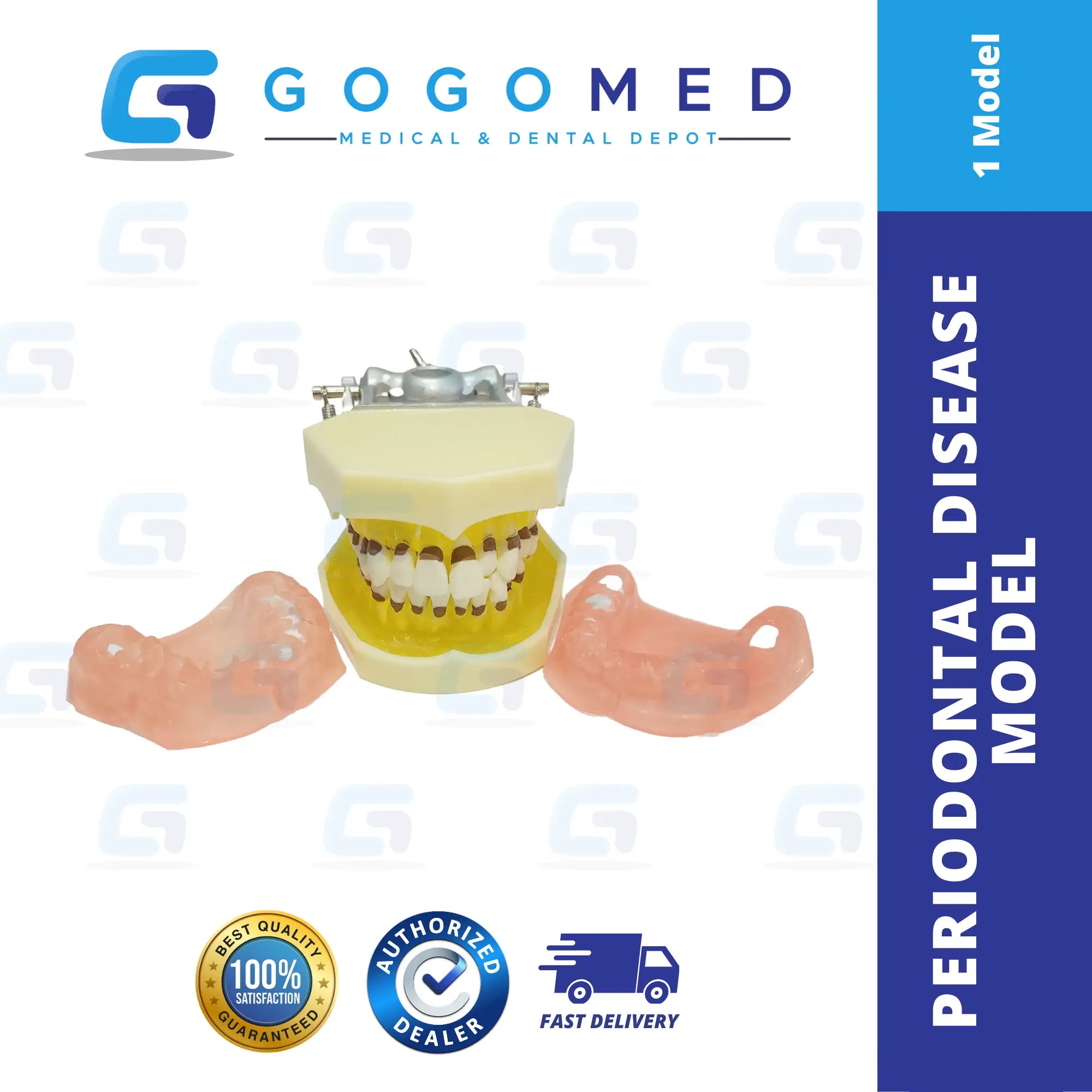 Periodontal Disease Model