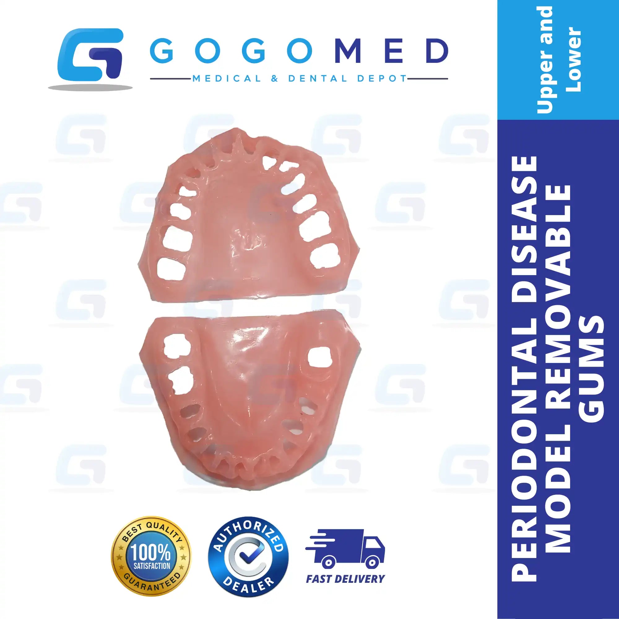 Periodontal Disease Model