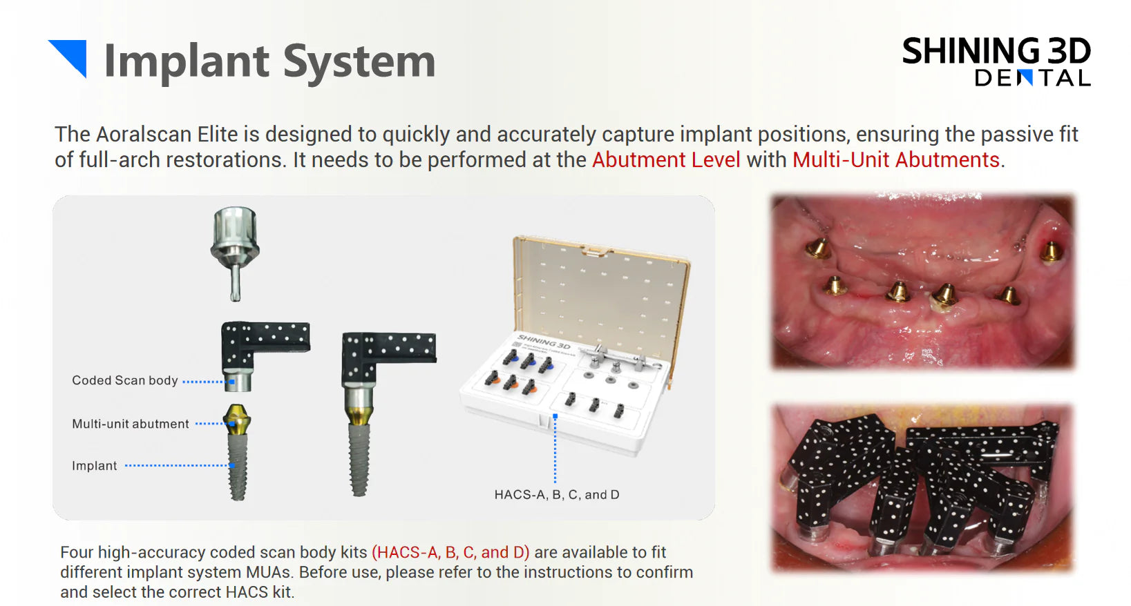 Scan Body Kit (Aoral Scan Elite)