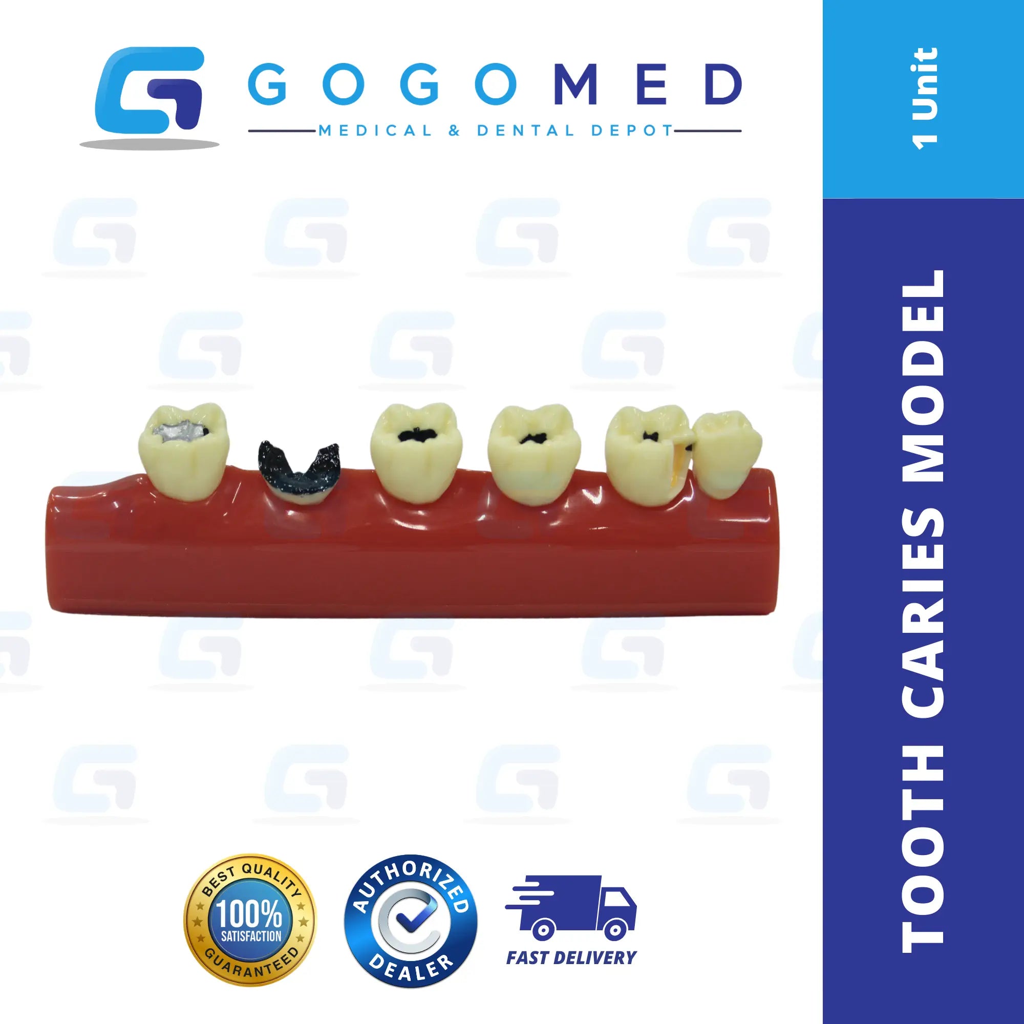 Tooth Caries Model