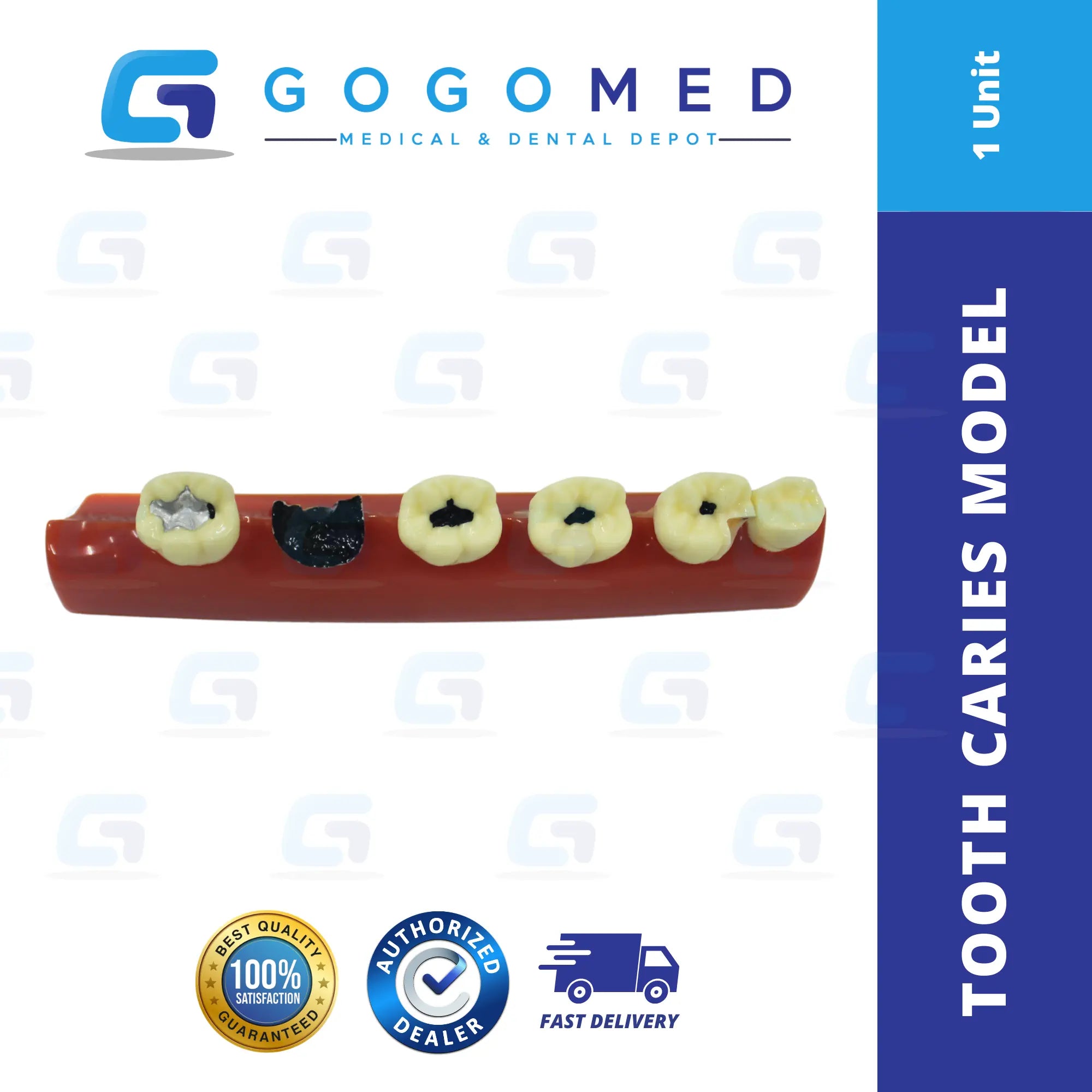 Tooth Caries Model