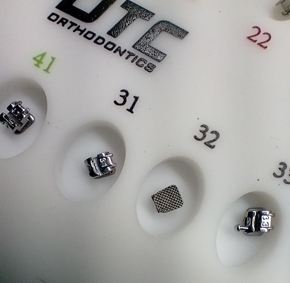 DTC Ortho Self-Ligating Brackets with Opening Instrument