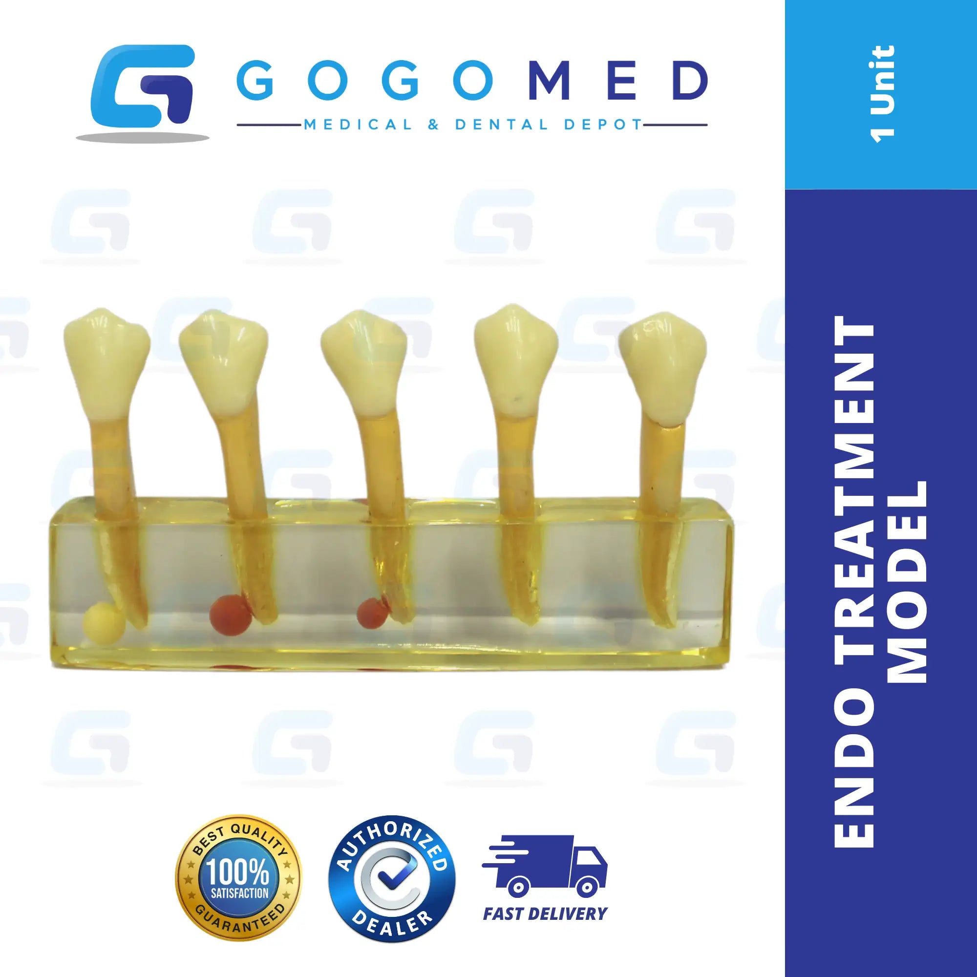 Endo Treatment Model