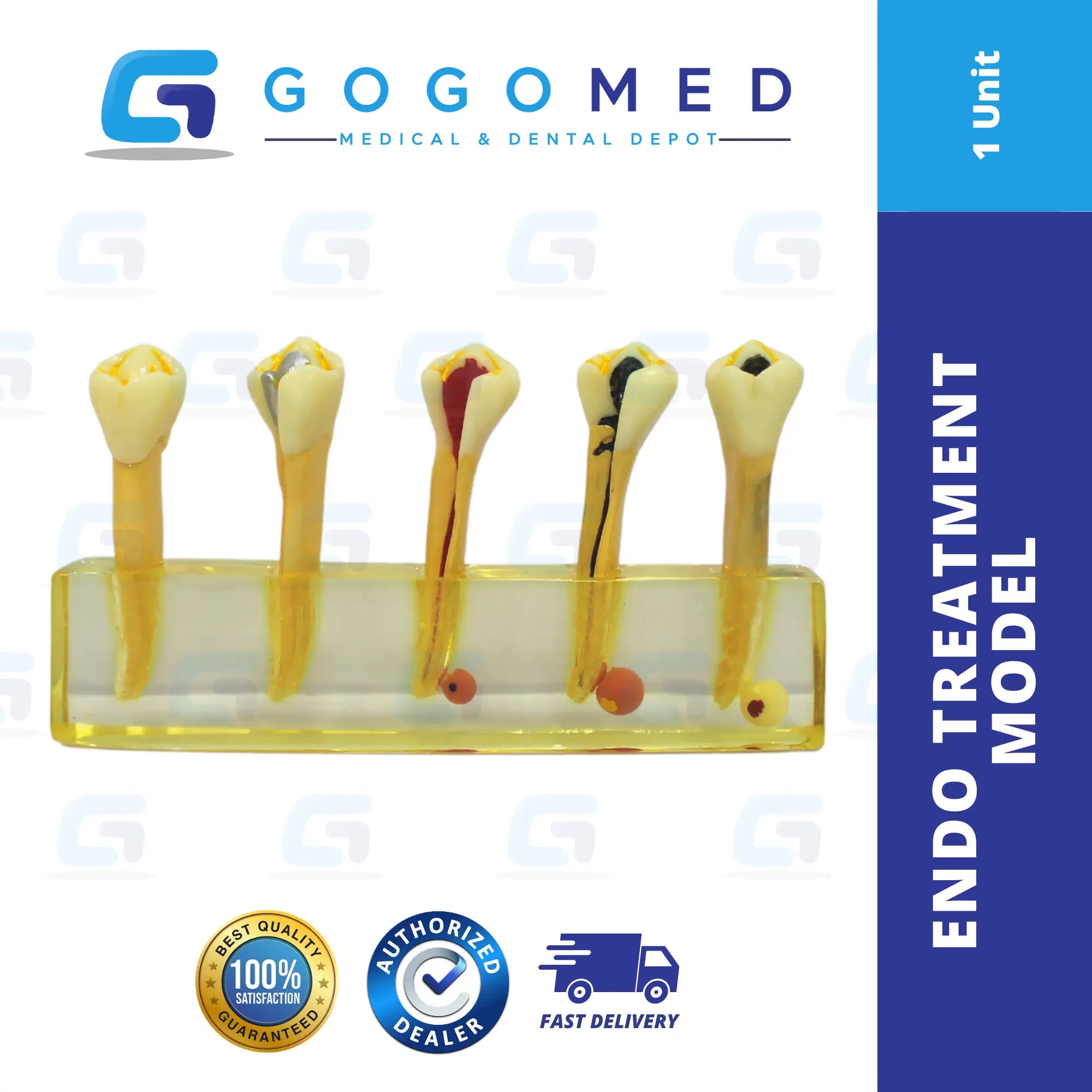 Endo Treatment Model