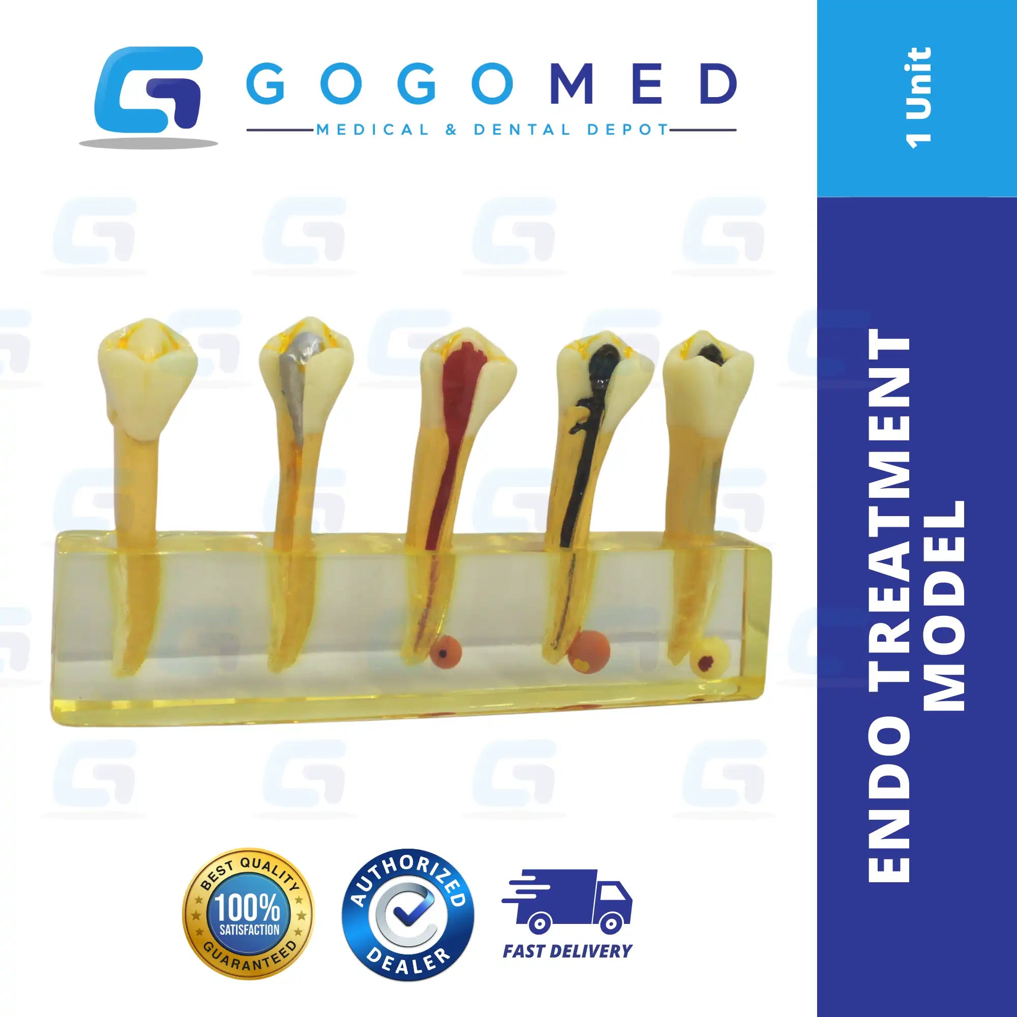 Endo Treatment Model