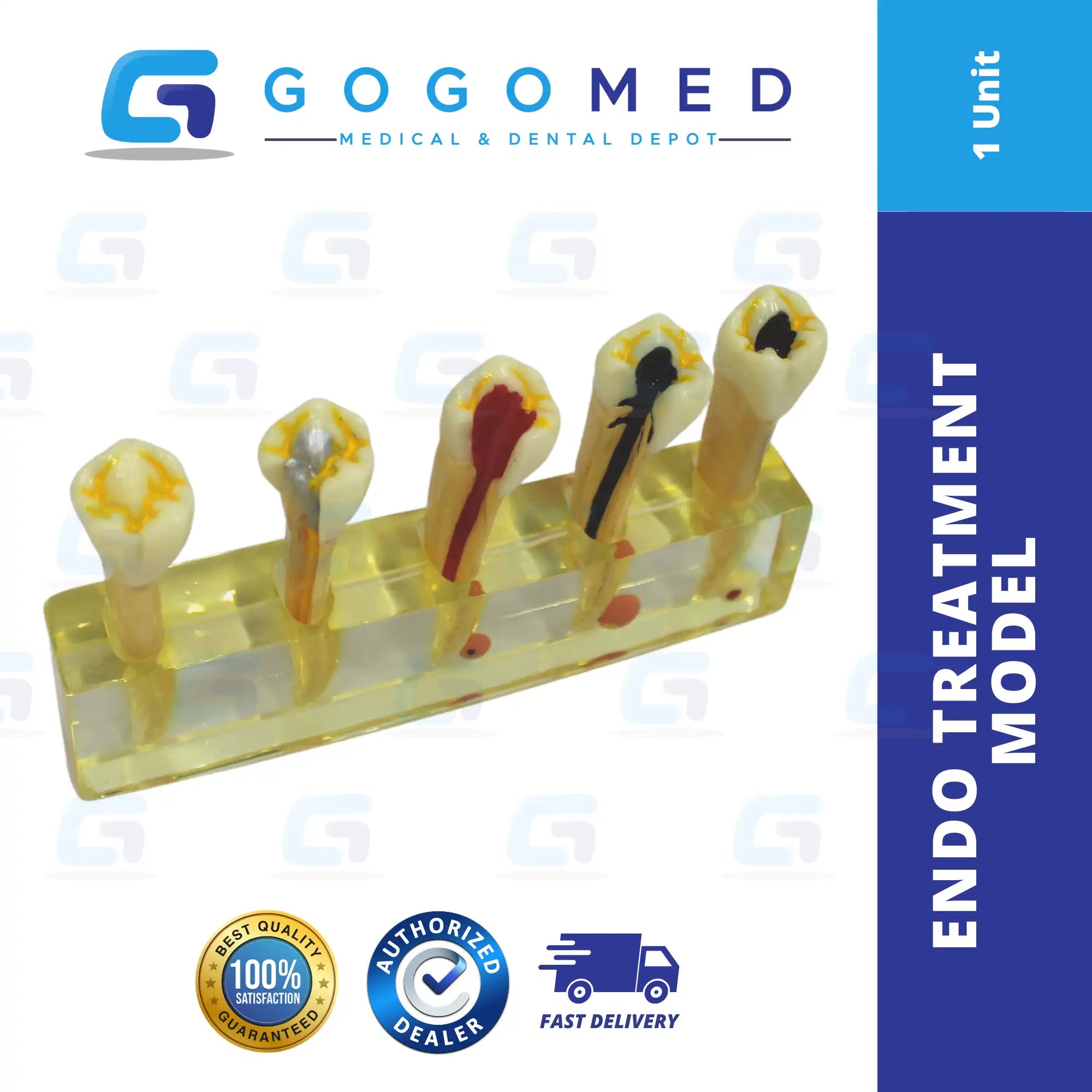 Endo Treatment Model