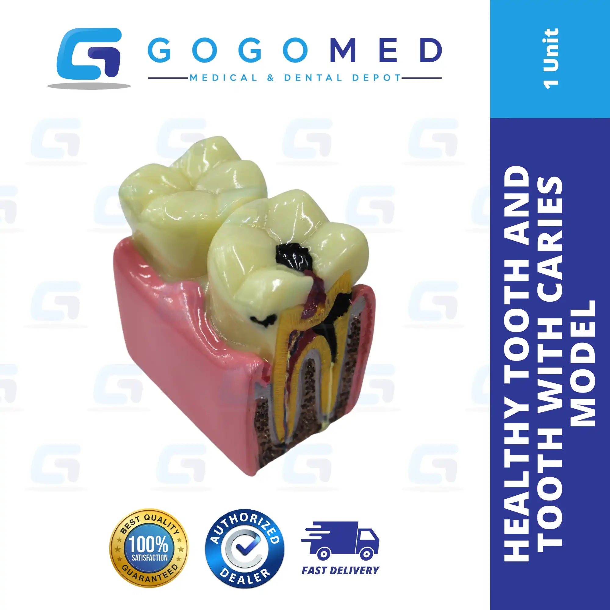 Healthy Tooth and Tooth with Caries
