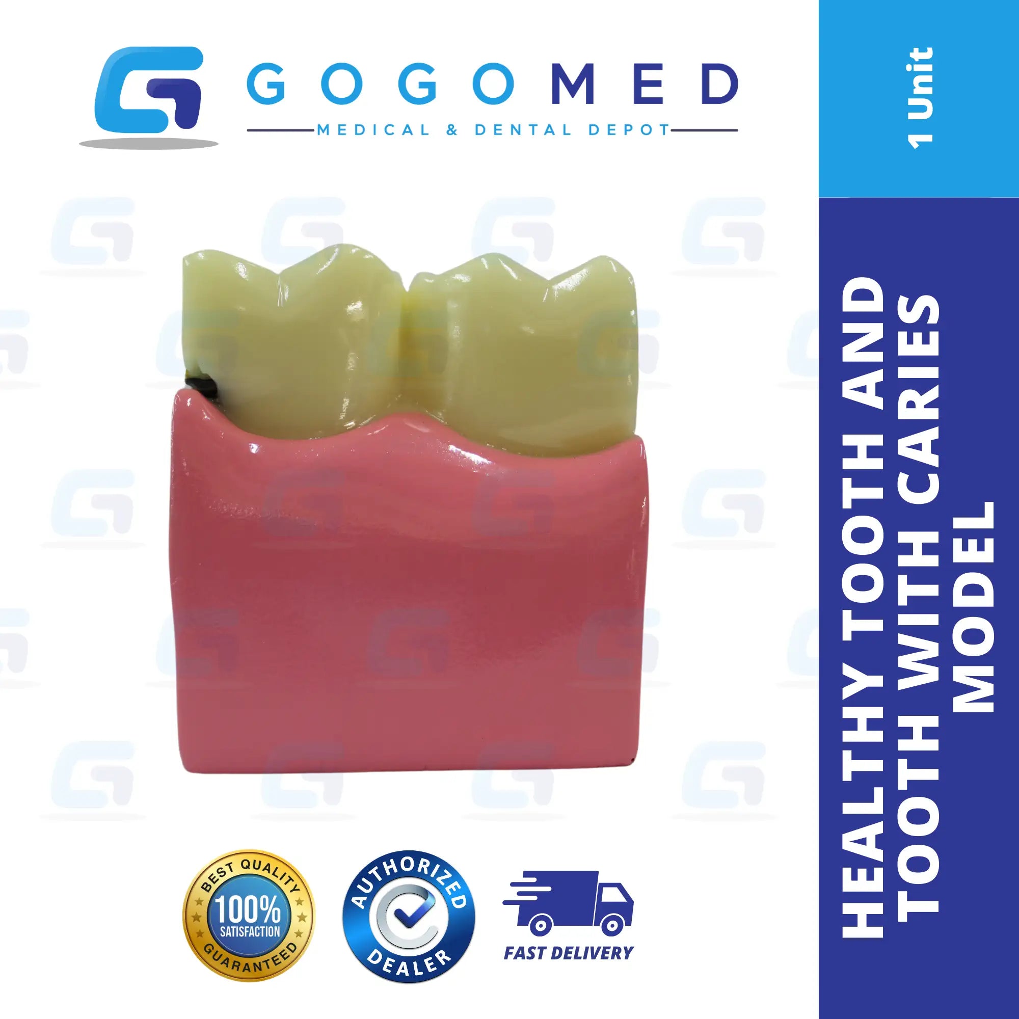 Healthy Tooth and Tooth with Caries