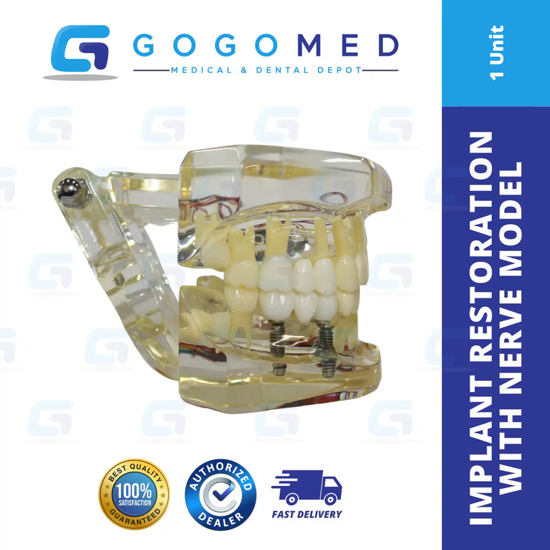 Implant, Restoration with Nerve Model