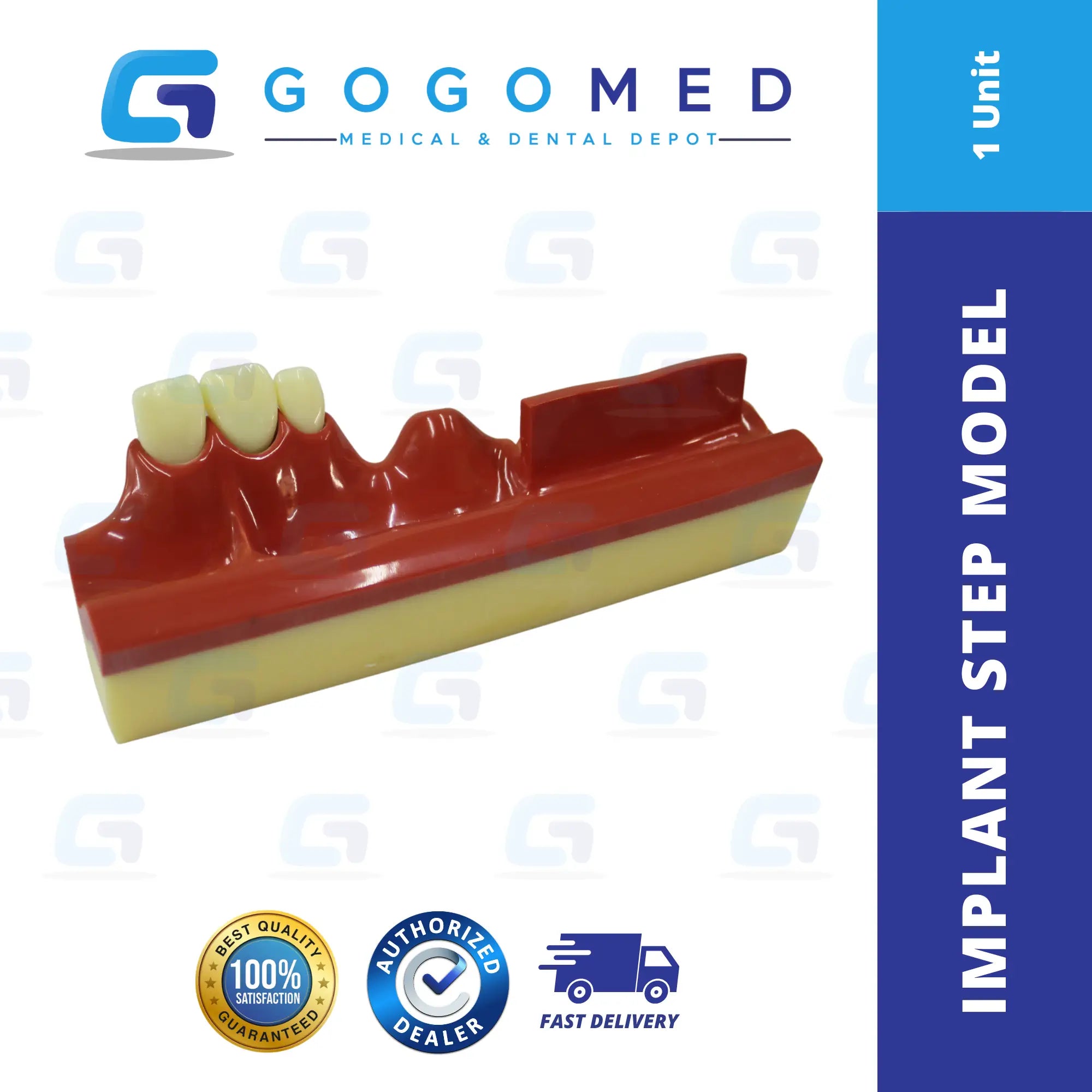 Implant Step