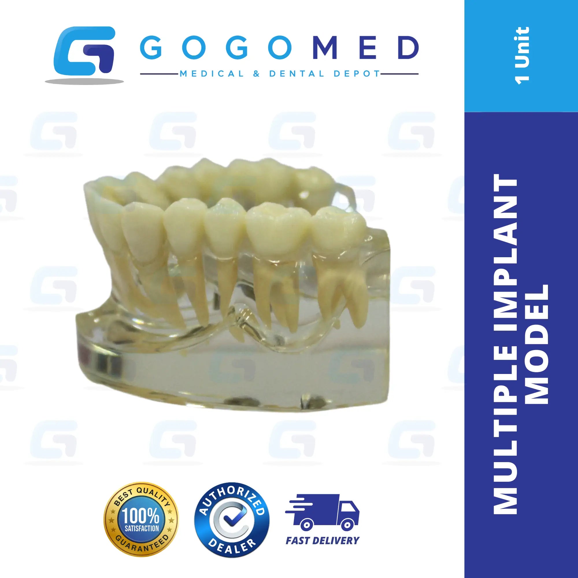 Multiple Implant Model