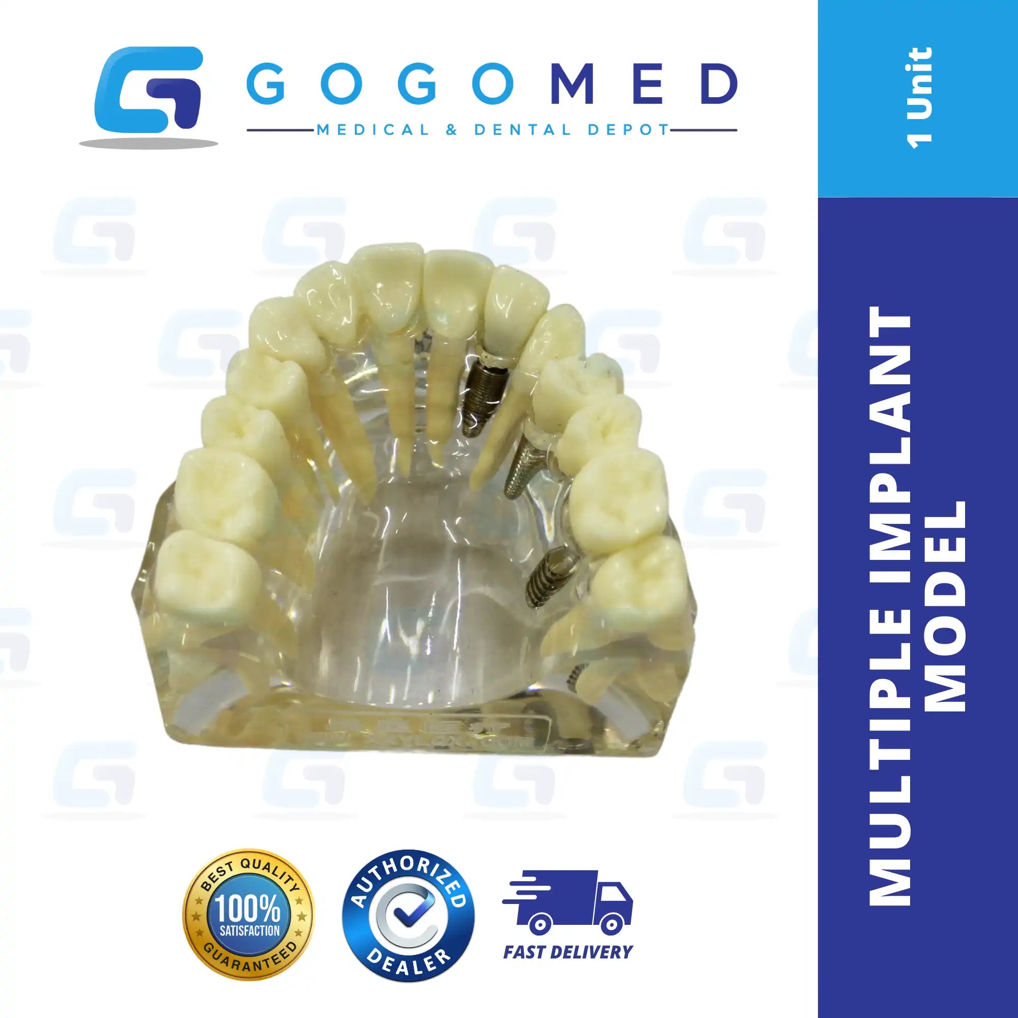 Multiple Implant Model
