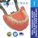 Oral Surgery Model with Articulator (Impacted Third Molar)