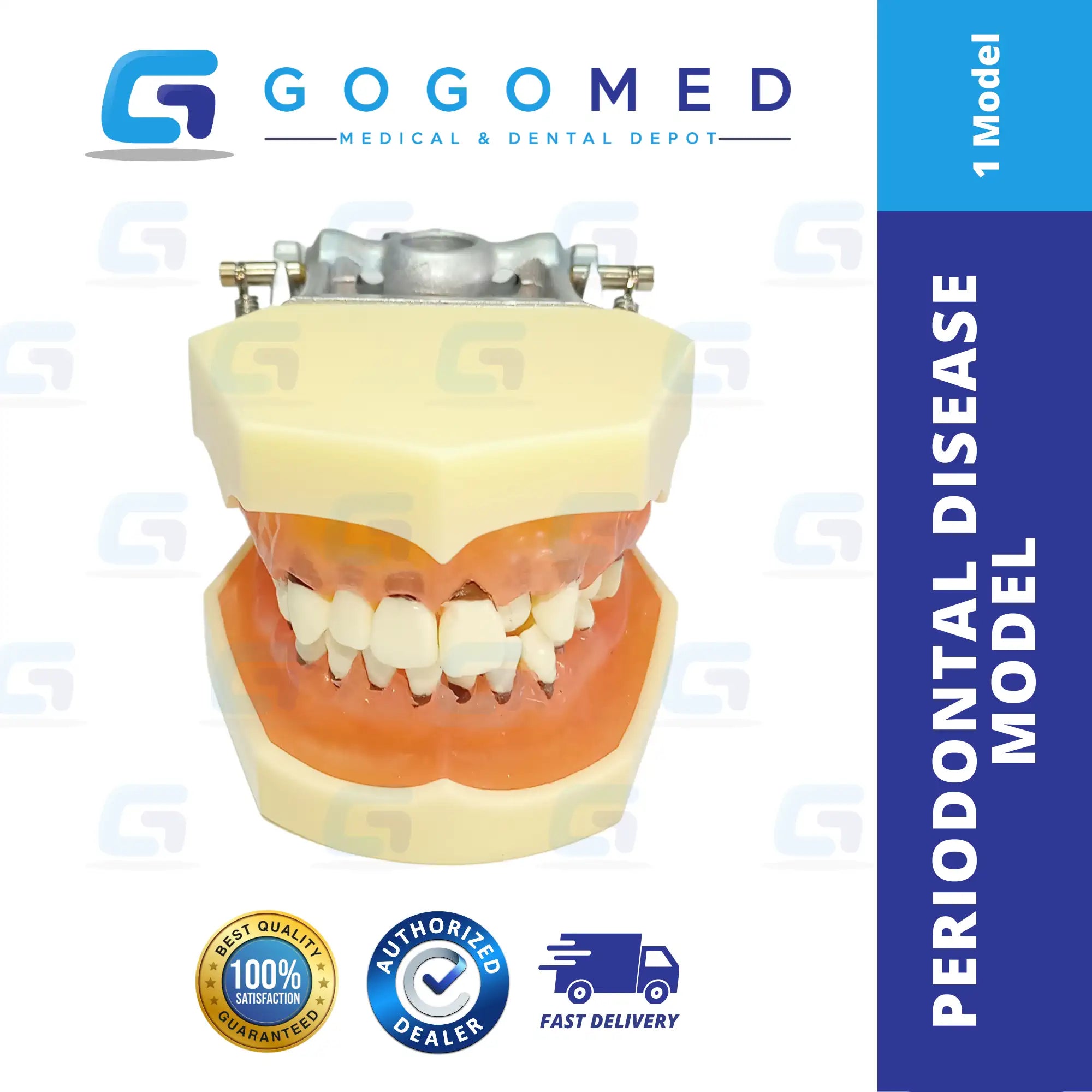 Periodontal Disease Model