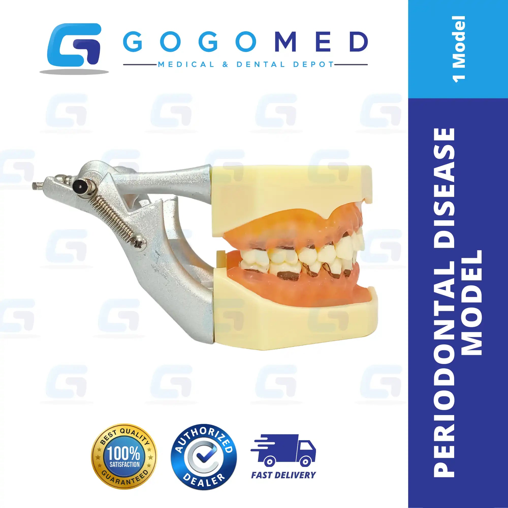 Periodontal Disease Model