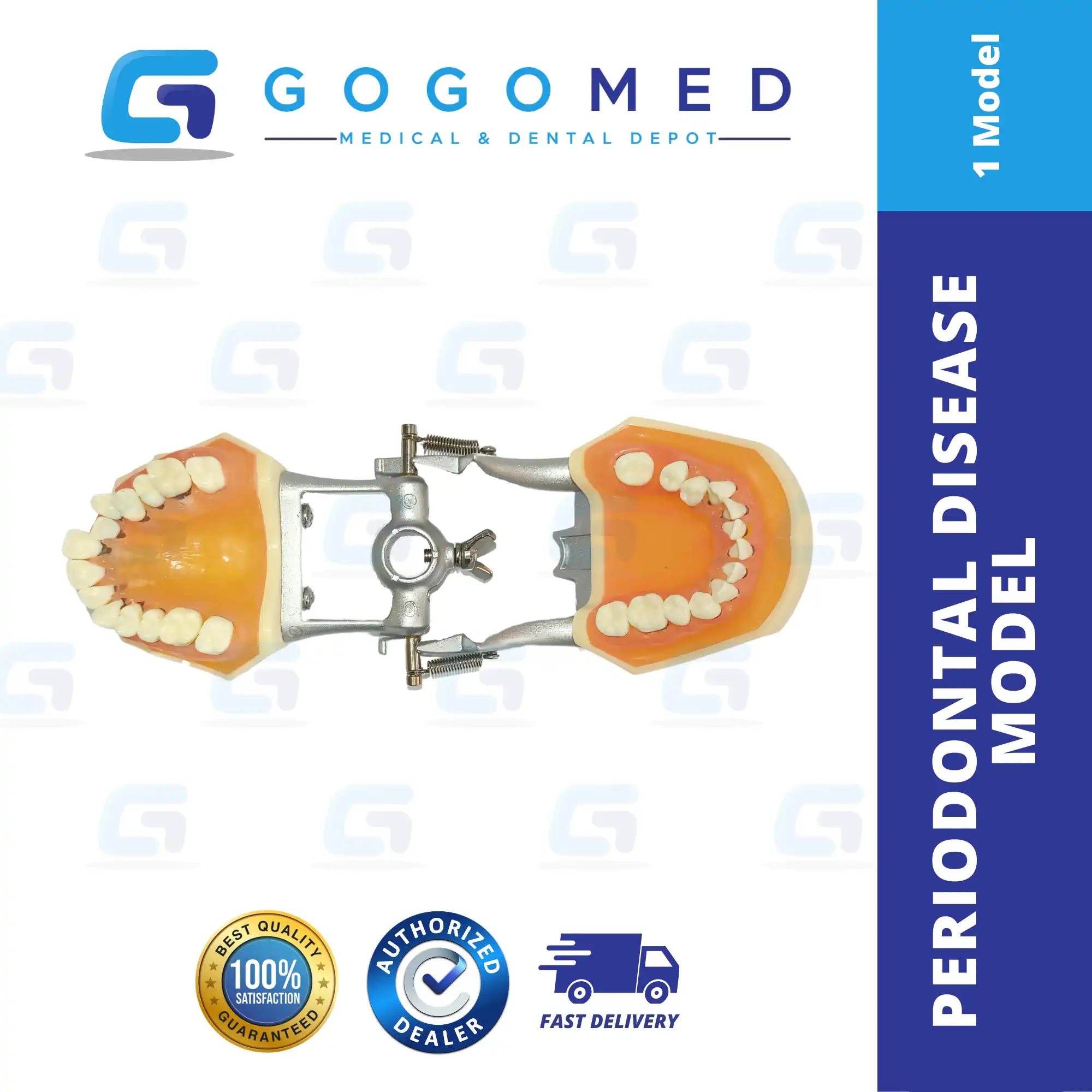 Periodontal Disease Model