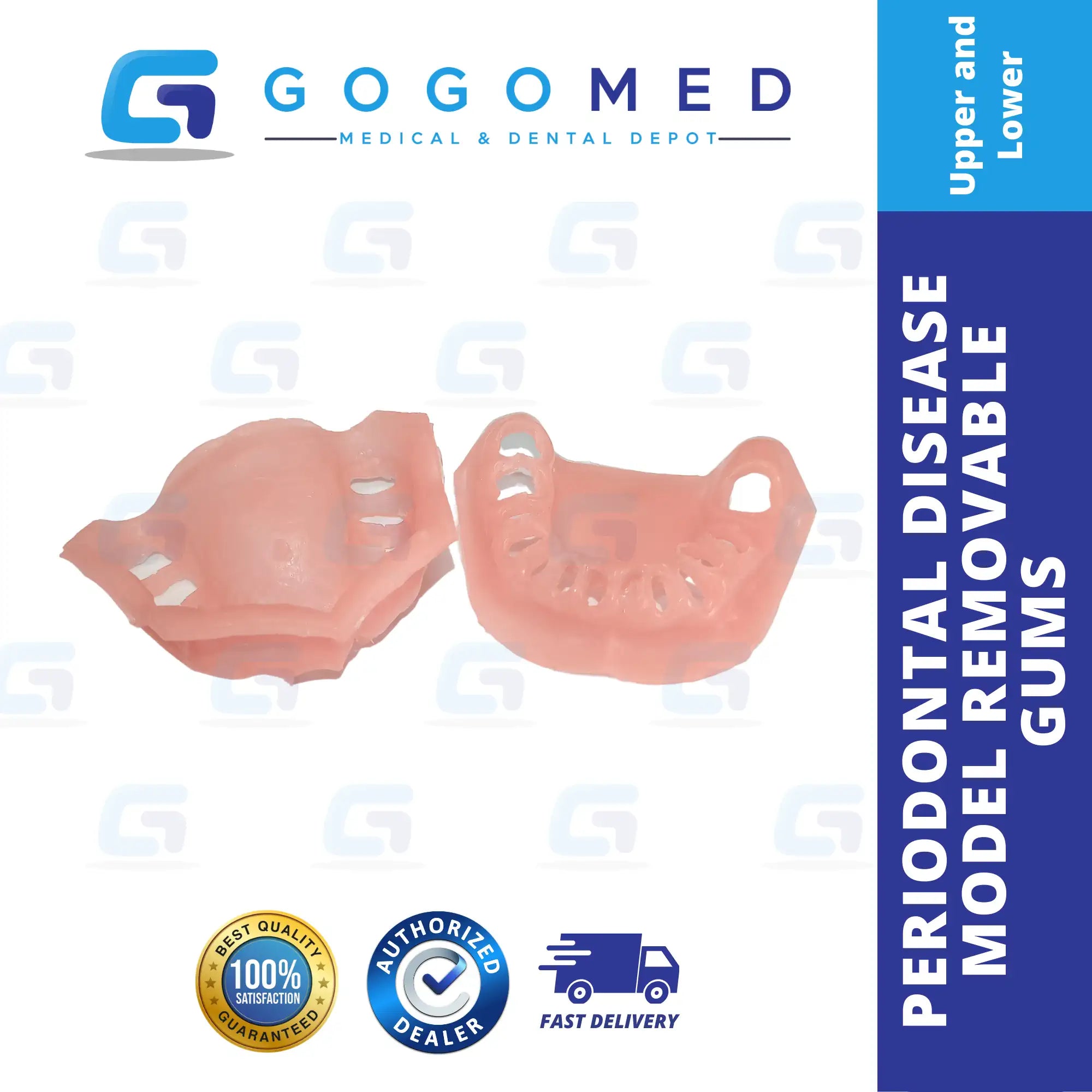 Periodontal Disease Model
