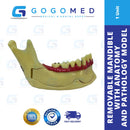 Removable Mandible Anatomy and Pathology