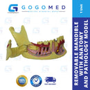 Removable Mandible Anatomy and Pathology