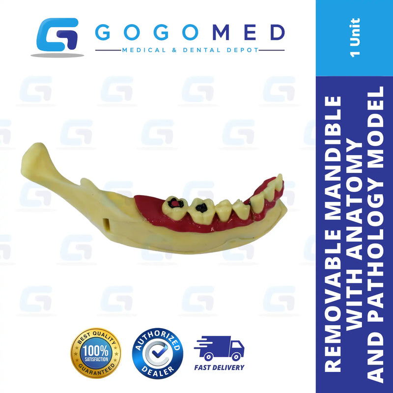 Removable Mandible Anatomy and Pathology