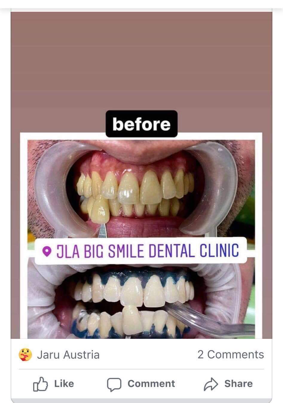 Smilin' Whitening System Kit