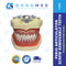 Perio Articulator Screw Removable Teeth (Transparent Pink Gums)